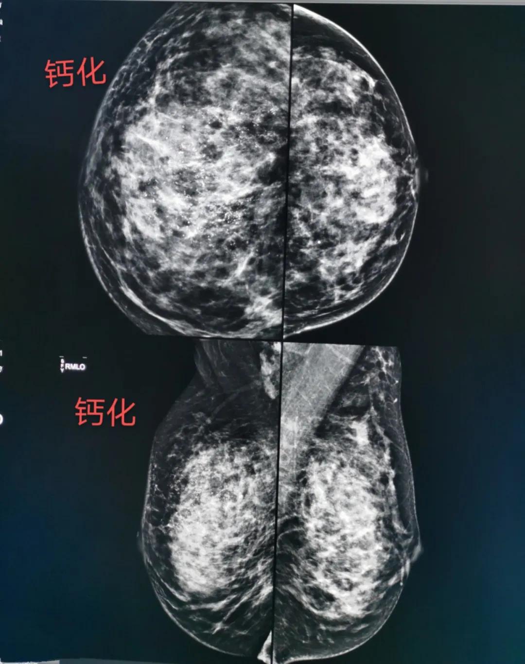 最新乳腺机，学习变化中汲取力量，拥抱自信与成就感