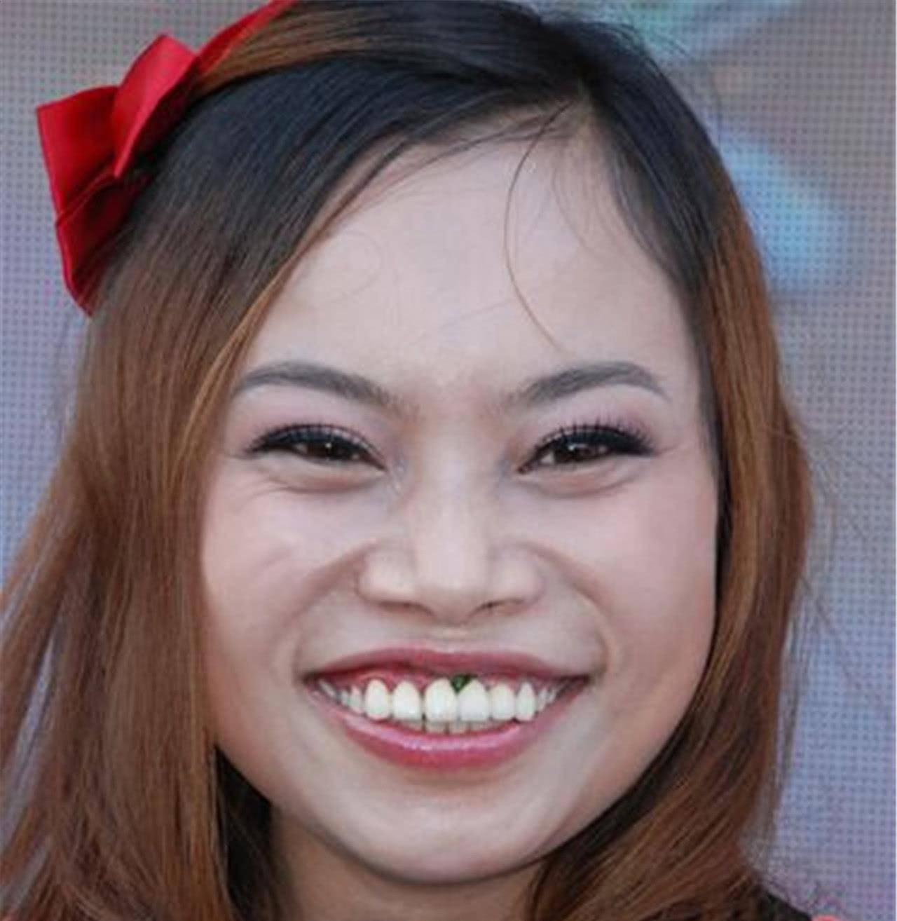 凤姐整容后最新照片，审美变迁下的公众观点探析与自我重塑之路