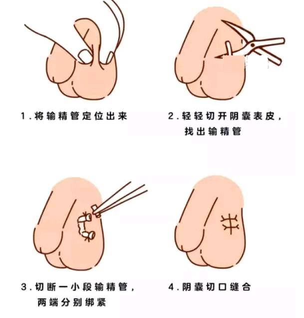 不锈钢链条 第322页