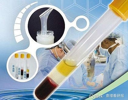 不锈钢链条 第289页