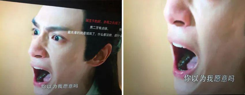 戴牙套的明星探寻小巷中的宝藏秘密